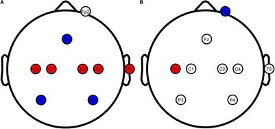 Transcranial Direct Current Stimulation Targeting the Entire Motor Network Does Not Increase Corticospinal Excitability
